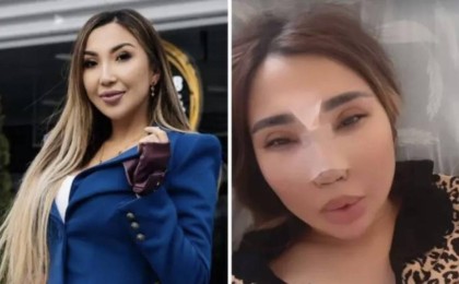 "Үсті-басым қан болды". Сиви Махмуди жан түршігерлік жол апатына түскенін айтты