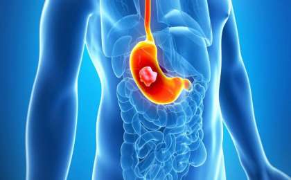 Асқазан туралы қазақша: қызметі мен құрылысы