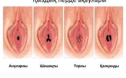 Әйел жыныс мүшелерінің ақаулары - презентация