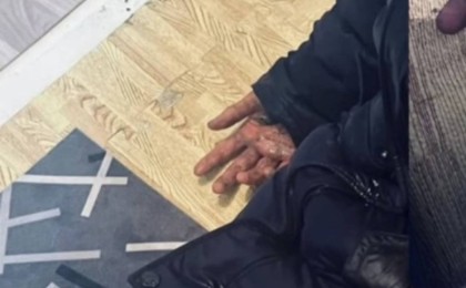 Қонаевта оқушылар сыныптасын соққыға жығып, жансақтау бөліміне түсірген