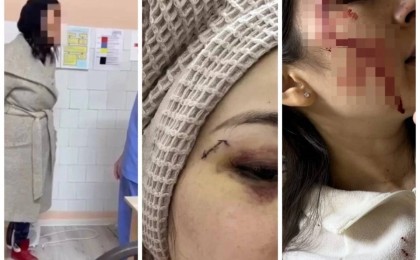 Кеудесін тістеп, шап тұсынан ұрған: Алматыда науқас дәрігерлерге шабуыл жасаған