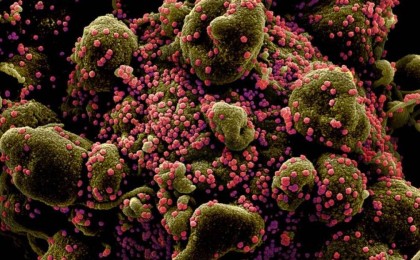 "Дүрлігуге негіз жоқ": Шымкентте екі тұрғын аса қауіпті дерт жұқтырды