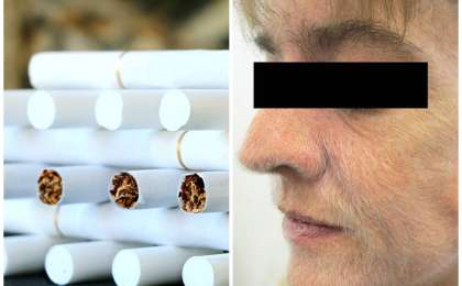 37 жыл шылым шеккен әйелді түк басқан