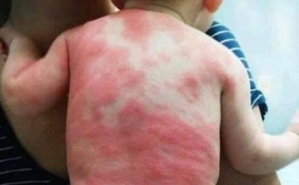 "Вакцина салған соң" түсірілген сурет қазақстандықтарды шошытты