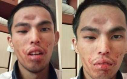 Алматыда әкесі баласын намаз оқымағаны үшін әбден ұрып, жансақтау бөлімінен бір-ақ шығарған