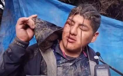 Тірідей жерленген ер адам көрден өздігінен шыққан (Фото)