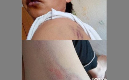 "Бәрі көк ала қойдай таяқ жеген": Белгілі заңгер елдегі қорғансыз әйелдерге араша түсті