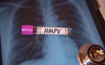 Қытайда басталған метапневмовирусы Қазақстанда да таралып жатыр