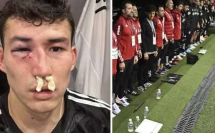 Қазақстандық футболшы Бақтияр Зайнутдинов ауыр жарақат алып, ауруханаға түсті