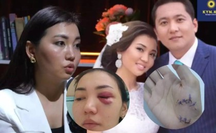 “Сіздерден көмек сұраймын” - Асхат Садырбайдың экс-жұбайы үндеу жасады