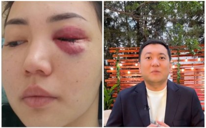 “Көзім ағып кете жаздады” - Асхат Садырбайдың экс-әйелі күйеуінен көрген қорлығын жайып салды