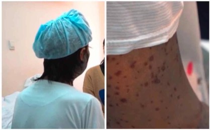 TikTok-та жарнамаланған дәріні ішкен шымкенттік әйел өлім аузынан аман қалды