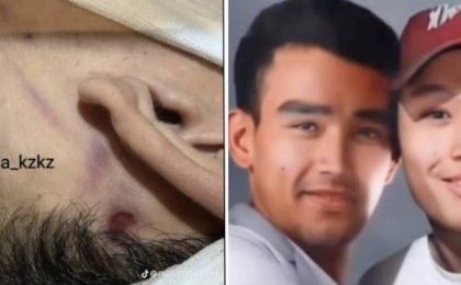 "Денесінде іздер бар": Адвокат Шерзаттың ағасының өліміне қатысты тың деректермен бөлісті