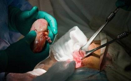 Президент қол қойды: Қазақстанда мәйіттің сау органы қызу саудаға түсуі мүмкін