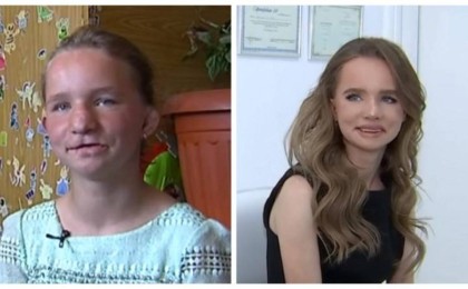 Туыстары келбетін жарақаттаған алматылық қыз адам танымастай өзгерді