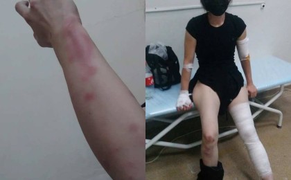 "Аяқ-қолымды сындырды": Алматылық әйел полицейлерден жәбір көргенін айтты