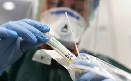 Коронавирусты жеңгендер неден зардап шегуде?