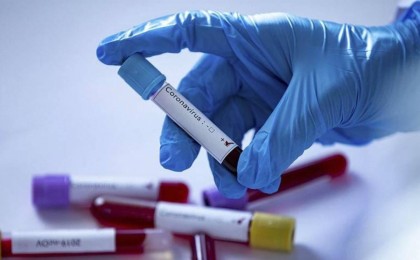 Қазақстанда бір тәулікте 2 мыңға жуық адам коронавирус жұқтырды