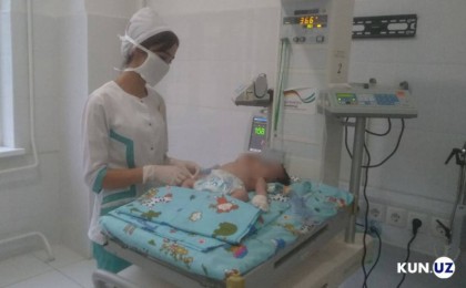 Өзбекстанда екі басы бар сәби туылды