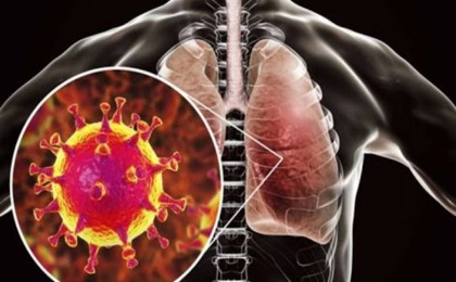 Сарапшы Қазақстанда пневмонияның пайда болу себебін атады: Бұл 99% коронавирус