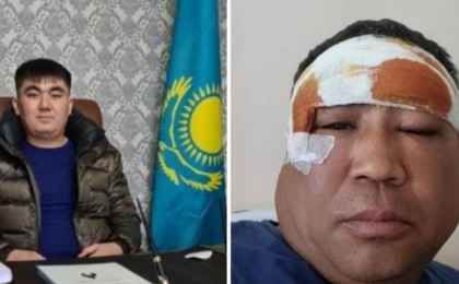 "AMANAT" партиясының депутаты фермерді соққыға жықты деп айыпталуда