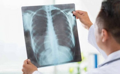 Нұр-Сұлтанда пневмониямен ауыратын 25 жастағы қыз қайтыс болды