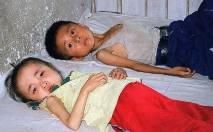 Солтүстік Кореядан қашқан адам елдегі қорқынышты аштық туралы айтты