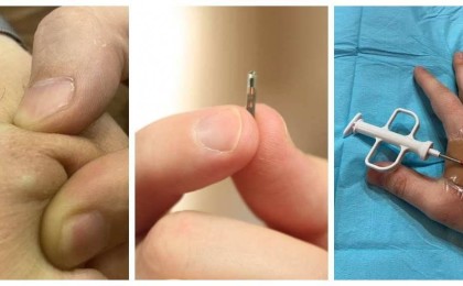 Чип салдырған бірінші қырғызстандық атанған жігіт тәжірибесімен бөлісті