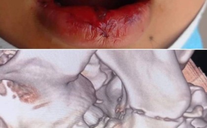 Атырауда 11-сынып оқушылары мектеп дәретханасында 10-сынып оқушысын соққыға жыққан