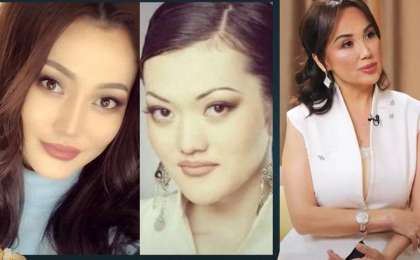 “Жақ сүйегін сындырған” - Ерке Есмахан пластикалық ота туралы айтты