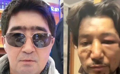 "Ғалымжанды есінен танығанша ұрған, оны алда операция күтіп тұр": Мұқасан Шахзадаевқа тықыр таянды