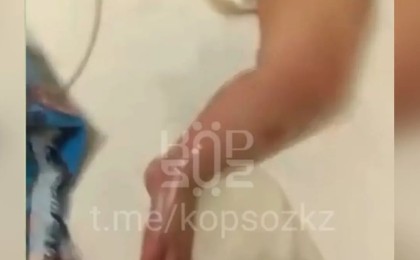 Астанада ауруханада 9 айлық сәби күйіп қалған