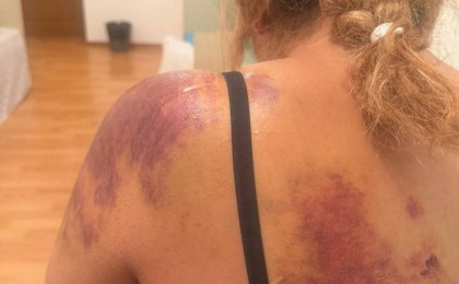 Жетісу облысында көршісін күрекпен ұрған күдікті бостандықта жүр