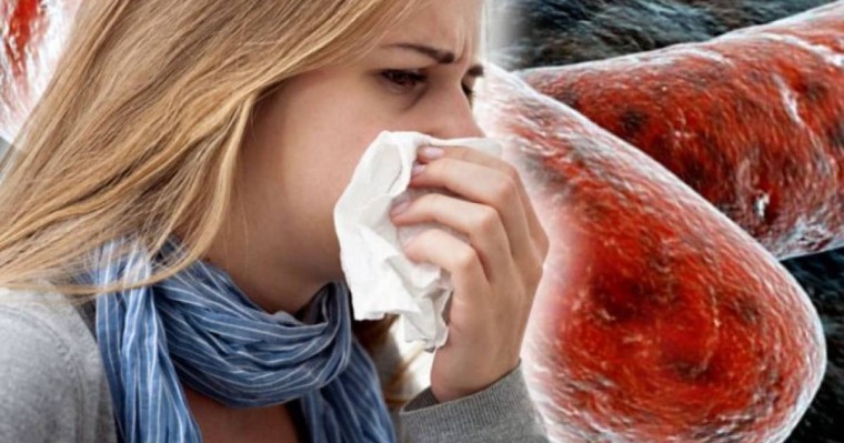 Астанада екі балабақша мен мектеп қызметкерлерінен туберкулез анықталды