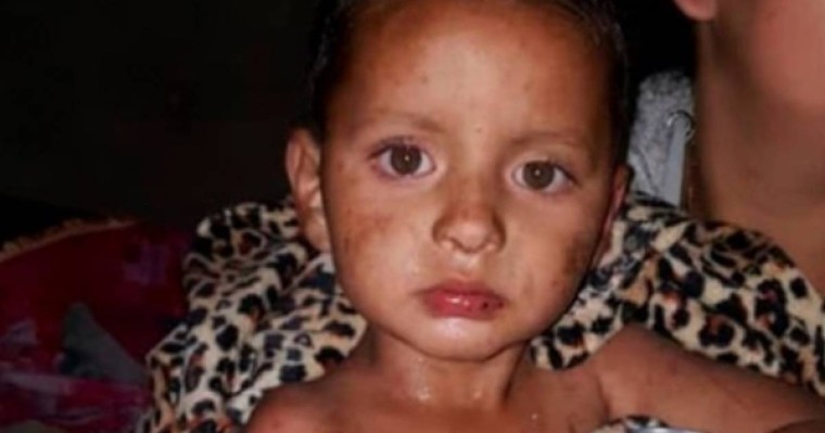 ​Екі жастағы бала бес күн бойы тауда ас-сусыз өмір сүрген