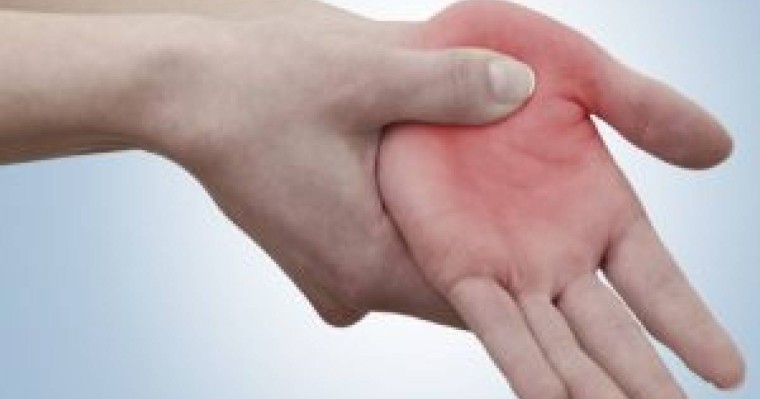 Алақан сүйектерінің диафиздерінің сынығы | KazMedic