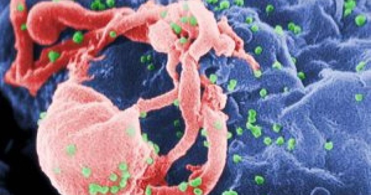 Лизосомалық аурулар