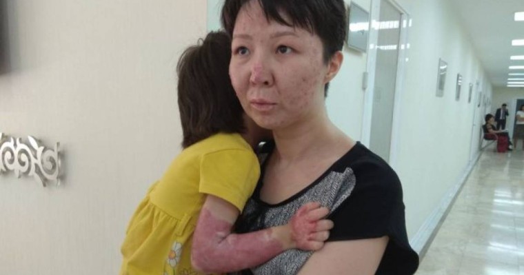 Ата-анасынан айырылып, мүгедек болып қалды: павлодарлық әйелдің жантүршігерлік оқиғасы