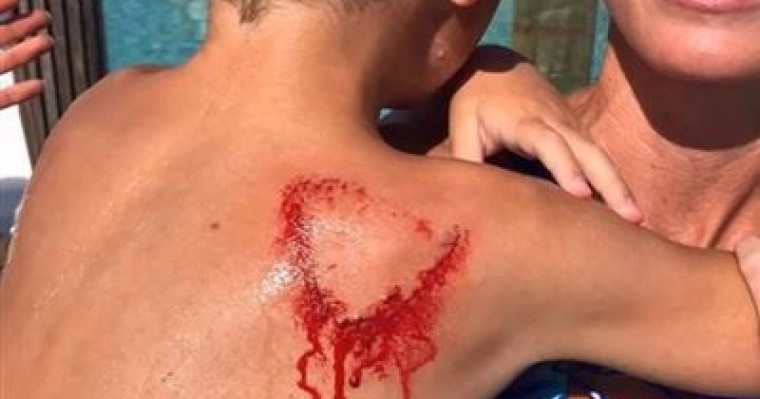 Әкесі ұлына жармасқан акуланы жұлып алды