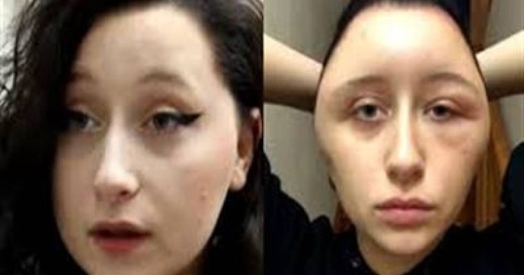 Шашын бояған бойжеткеннің беті ісіп кеткен