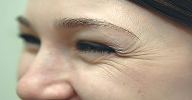 Әжімдер сіз туралы не айтады?