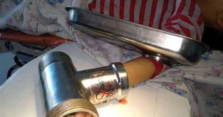 Ет турағыш машина сәбидің саусақтарын жұлып кетті