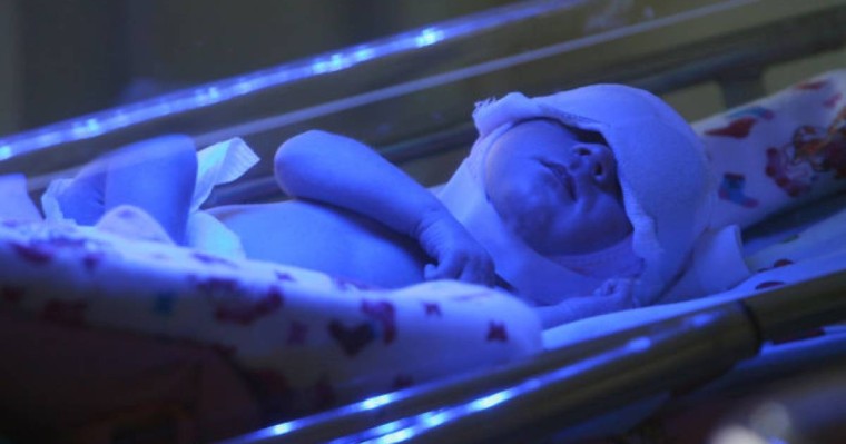 Ұлыбританияда терісіз сәби дүниеге келді