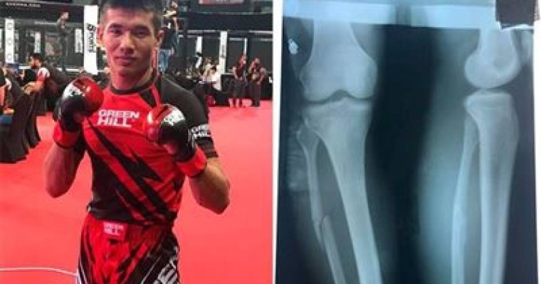 Қазақстандық спортшы сынған аяғымен жеңіске жетті