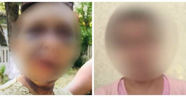 "Ауызында бір тісі жоқ": Шымкентте белгісіз біреулер аяусыз соққыға жыққан әйелдің әпкесі оқиға туралы айтып берді - Қазақстан жаңалықтары