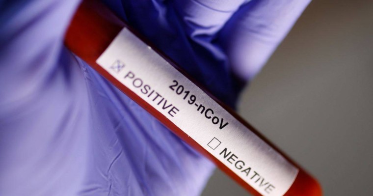 Ресейде екі адам коронавирус жұқтырғаны анықталды