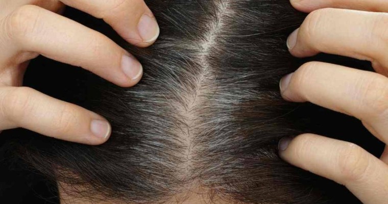 Елімізде сәбилердің шашы ағарып, жеткіншектердің шашы түсіп жатыр