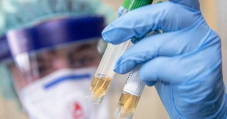 Бірінші тест теріс нәтиже көрсеткен: Павлодарда вирустан көз жұмғандардың саны неге көп - Қазақстан жаңалықтары