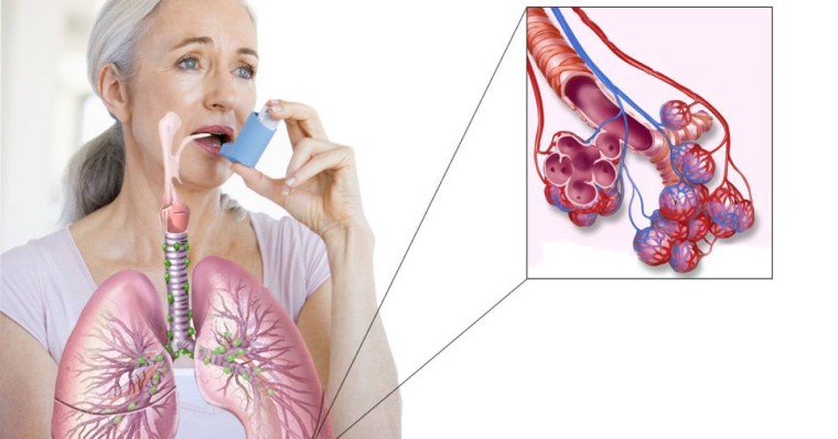 Дүниежүзілік демікпеге қарсы күрес күні