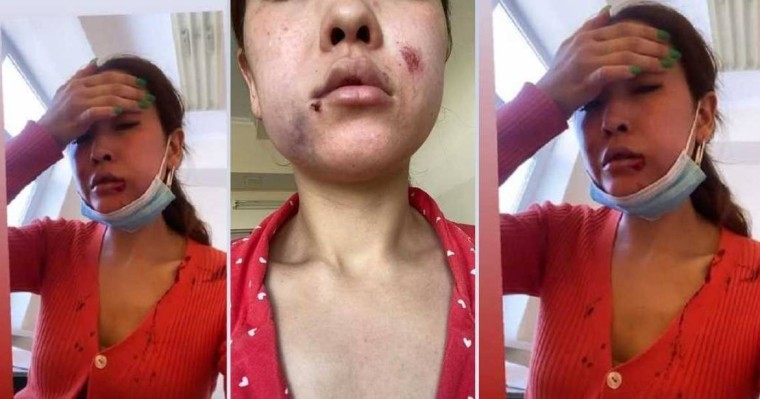 "Көлікке қамап қойып ұрып-соқты": Түркістандық бұрынғы әйелін аяусыз ұрған